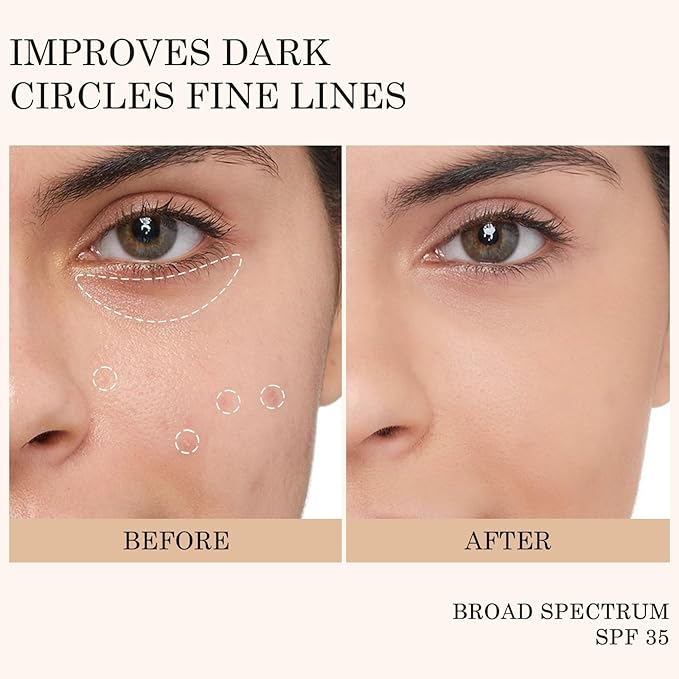 KYDA Mineral Sunscreen Eye Cream, 3-in-1 Anti-Aging Eye Cream, SPF 35, for Dark Circle and Fine Lines, Medium