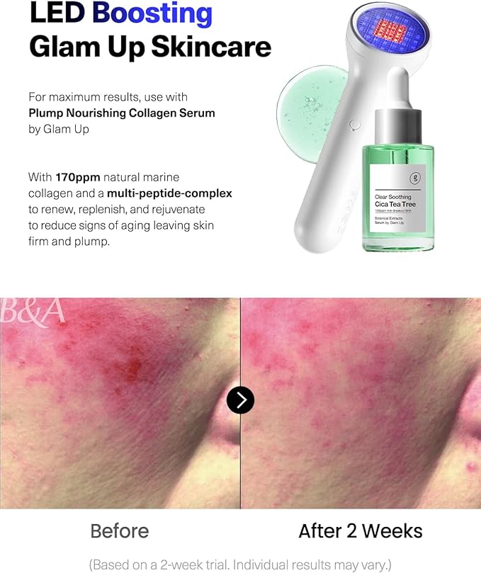 Anti-Breakout Blue Beauty Beam by CELLECT Red Infrared Blue LED Handheld Portable Blemish Clearing Therapy Facial Skincare Device for Spa & Home