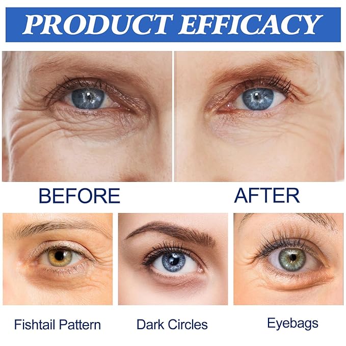 12 Picecs Malora Microglow Eye Patches,Hyaluronic Patchess for Under,Malora Under EyePatches for Wrinkles,Reduces Puffiness & Eye Bags,Under Eye Wrinkles Hydrating Sticker Mask (2Box)