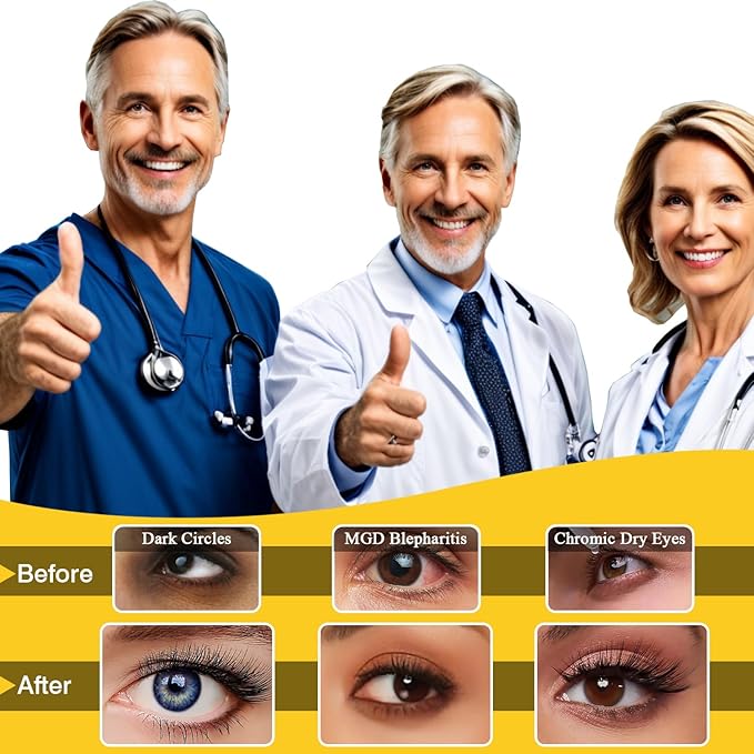 30 Pcs Steam Eye Mask for Puffy Eyes & Dark Circles, Self-Heating Sleep Mask for Travel Essentials, Hydrating & Soothing Eye Patches, Self-Care SPA Relaxation Gifts for Women, Men,Stocking Stuffers