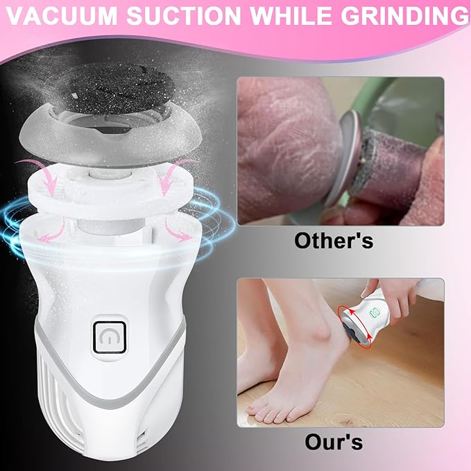 Electric Foot File for Dead Skin Removal, Callus Remover for Feet, Featuring a Dander Vacuum Foot Scrubber with 2 Speeds and 6 Grinding Heads, Foot Calluses Remover Kit for Cracked Skin.