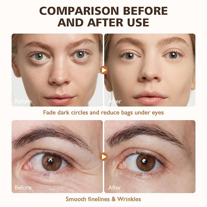 2PCS Revive Glow Vitamin C Eye Balm, Hydrating Eye Cream,Improve Dark Circles,Brightens Skin Tone,Reduces Puffiness