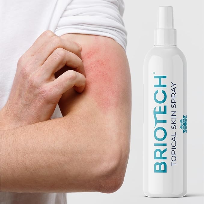 BRIOTECH Topical Skin Spray, Hypochlorous Acid Spray for Body & Face, Eyelid Cleanser, HOCl Facial Mist, Support Against Irritation, Calm Redness, Soothe Foot & Scalp, 8 fl oz, 1 ct