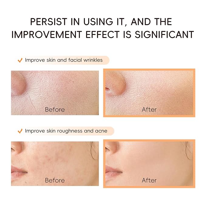 Korean Skin Care Set, Snail Mucin 97.5% Repair Cream, Collagen Facial Facial Moisturizer, Mother Day Gifts, Hydrating Repair Face Cream, Anti-Aging, Korean Skincare for Women