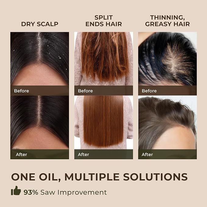 Gya Labs Peppermint Essential Oil for Diffuser & Hair - Huge 4 Fl Oz - 100% Pure Natural Peppermint Mint Oil for Skin, Face, Body, Self-Care - Cooling, Minty Scent for Aromatherapy & Candle Making