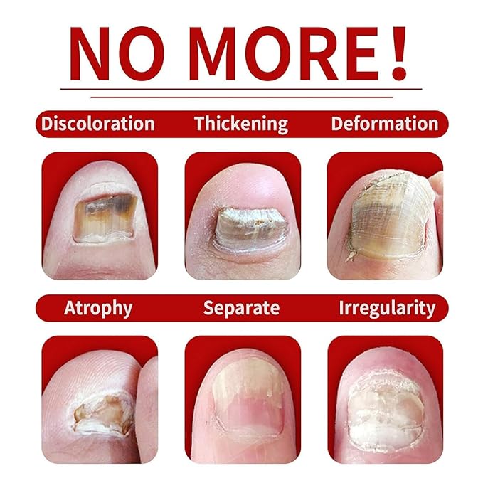 3PCS Ginger Nail Care Serum - Moisturize the Cuticle & Strengthen Nails and Helps Nails Healthy Grow