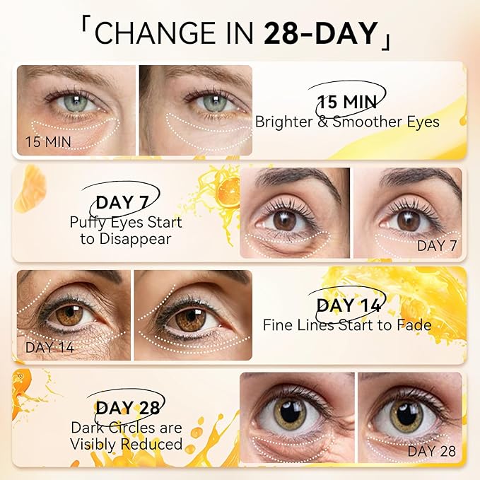 LANBENA Vitamin C Under Eye Patches for Dark Circles and Puffy Eyes, Cooling Eye Masks for Eye Bags, Fine Lines & Wrinkles Reduce, Anti-Aging, with Niacinamide Hydra-Gel Collagen-30 Pairs