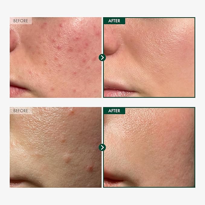 Madagascar Centella 86% Ampoule with 860,048ppm Centella Asiatica, Soothing, Calming, Facial Serum for face, for All Skin Types, Korean Skin Care, 100ml, 3.38fl.oz.