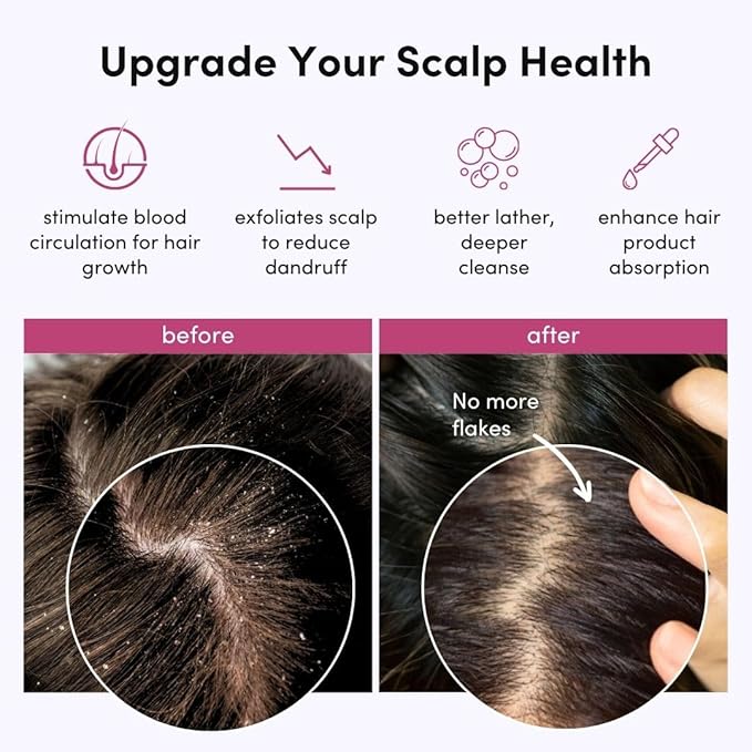 Fancii Hair Scalp Massager, Shampoo Brush for Wet & Dry Hair, Scalp Scrubber Exfoliator for Dandruff Removal & Hair Growth. Shower Head Brush for All Hair Types, Soft Silicone (Mint)