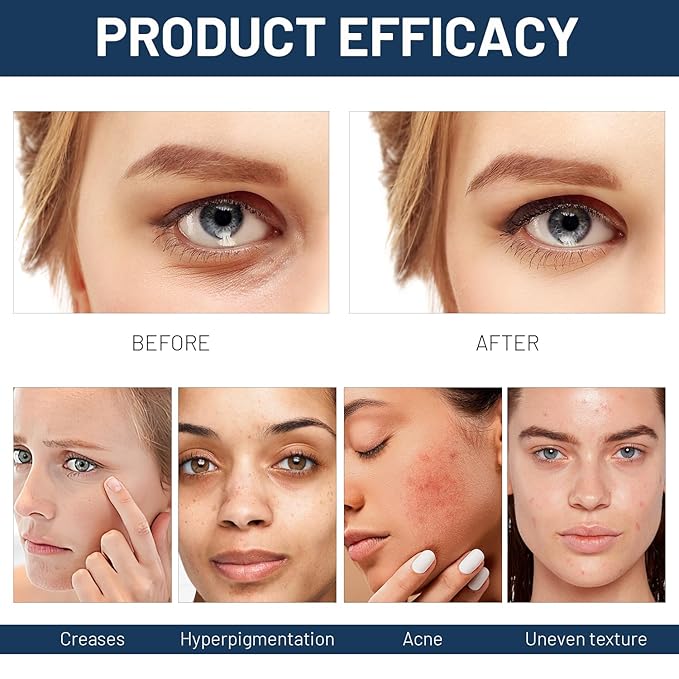 2 PCS Paracress Facial Oil, Paracress Serum,Paracress Facial Oil Organic, Paracress Facial Serum Organic,Paracress Extract Face Oil,Smooth Wrinkles Fine Lines Oil Face 30ml, 1.0 oz