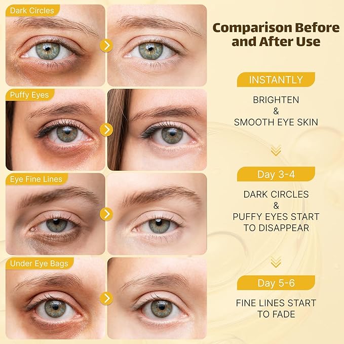 Under Eye Patches for Puffy Eyes and Dark Circles (20 Pairs) Collagen Eye Patches with Hyaluronic Acid & Niacinamide, Eye Mask for Moisturizing, Fine Lines, Dark Circles Under Eye Treatment