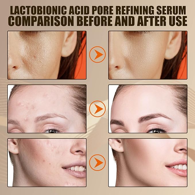 Lactobionic Acid Pore Refining Serum,Minimize Pores Serum Gentle Formula Clean Pore Shrink Pore Firming Skin Reduce Fine Lines Facial Liquid for All Skin