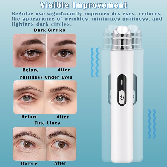 Eye Lift Wand Chargeable Face Massager Tool for Dark Circles, Eye Bags, Puffiness Under Eyes Massager for Lines, Smooth Lip Wrinkles Heated Massager Wand Enhance Absorption Anti Aging (White)