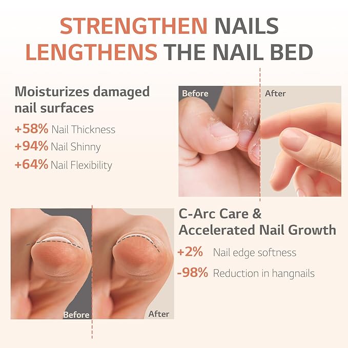 Aokitec Natural Cuticle Oil - Milk & Honey Flavor Cuticle Oil for Nail Growth and Strengthener with Vitamin E Repair Damaged Skin and Thin Nails Moisturizes Cuticle & Overnight Cuticle Softene