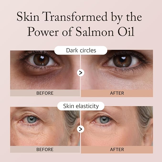 Salmon Peptide Eye Care Duo – Cooling Hydrogel Patches & Nourishing Eye Cream for Refreshed, Hydrated Eyes – Korean Skincare