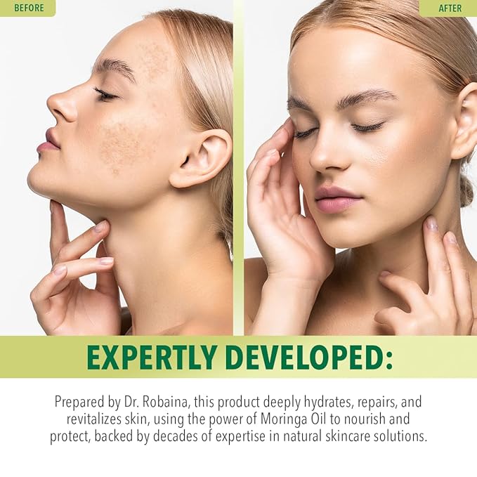 Dr. Robaina 100% Pure Moringa Oil – Deep Hydration, Skin Repair & Natural Antioxidants – Cold-Pressed, Organic & All-Natural Moisturizer – Made in USA