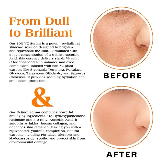 Face Serum Duo – Retinol Serum for Face & Vitamin C Serum – Anti Aging Skin Care Set for Women – Skin Care for Bright, Anti Wrinkle, Smooth, & Firm Skin – 1 fl oz, 2 Bottles