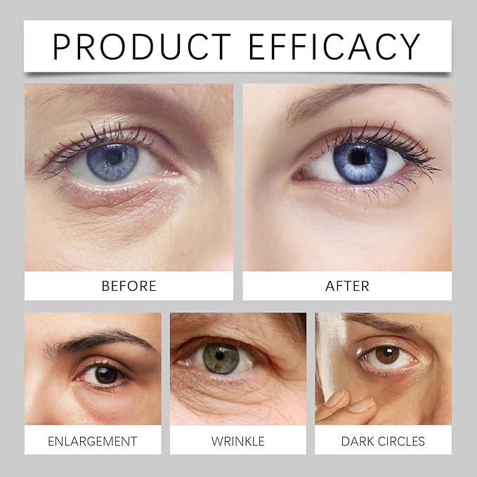 Lumibalm Erases Eye Bags within Minutes, Lumibalm for Under Eye Bags Lumibalm Eye Serum Lumibalm Stick for Under Eye Bags Turmeric Retinol Anti Aging Eye Cream Stick Reduce Fine Lines (1)