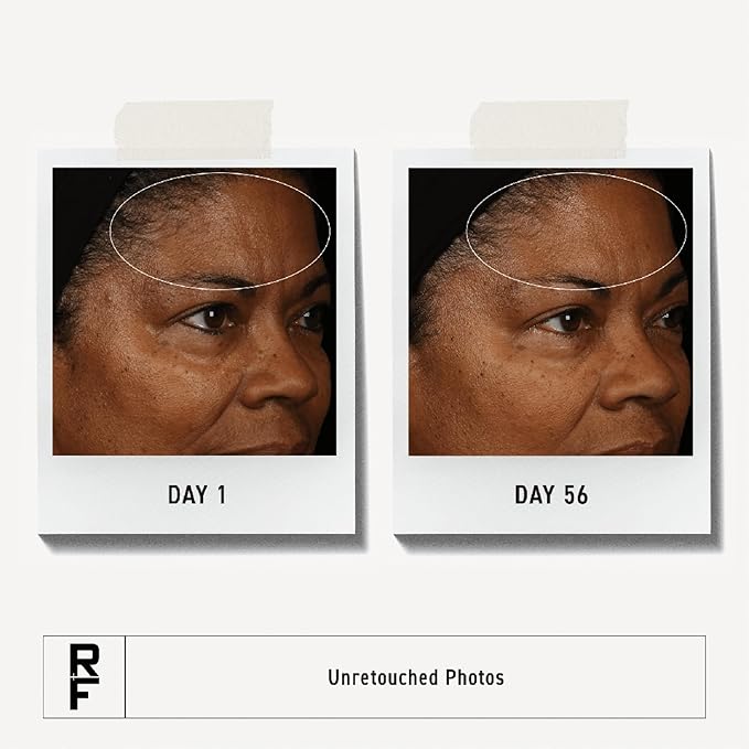 RODAN + FIELDS Redefine Overnight Reparative Lotion | Anti Aging Face Moisturizer for Fine Lines, Deep Wrinkles, and Firmness | With Peptides, Retinol, and Vitamin B3 | Lightweight Skin Care