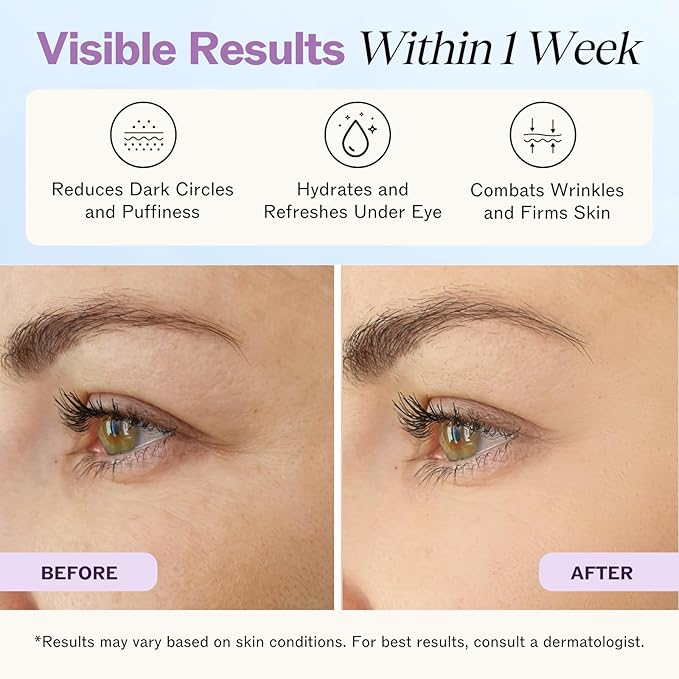 LilyAna Naturals Eye Cream for Dark Circles and Puffiness, Under Eye Cream for Wrinkles and Bags, Anti Aging helps Improve Dryness; for Sensitive Skin (1.7 Ounce, Pack of 2)