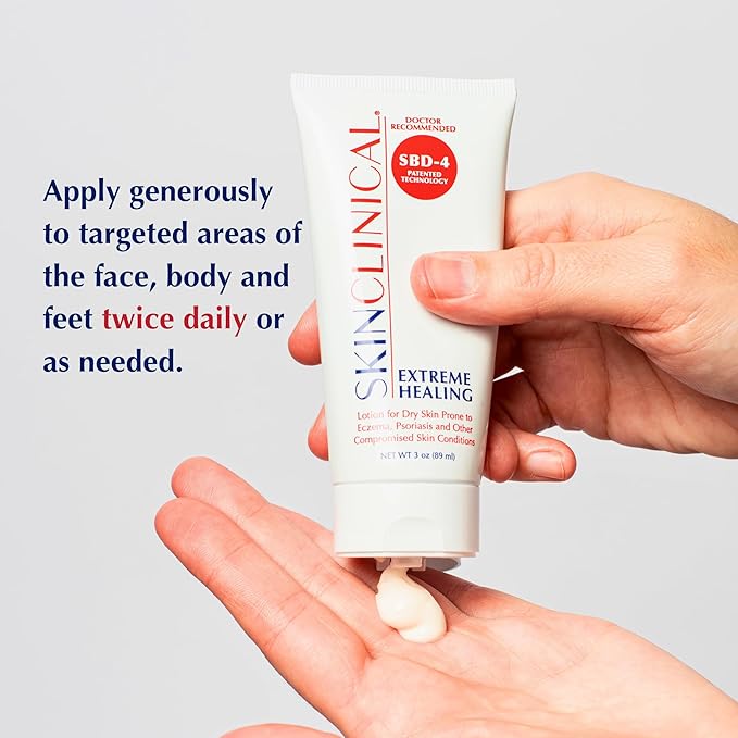 Extreme Healing, Non-Sticky, Fast-Absorbing Lotion For Dry Skin with Eczema and Psoriasis, Fragrance Free Lotion with Patented Ingredient SBD-4, Soothing Relief for Hand and Body, 3 Oz