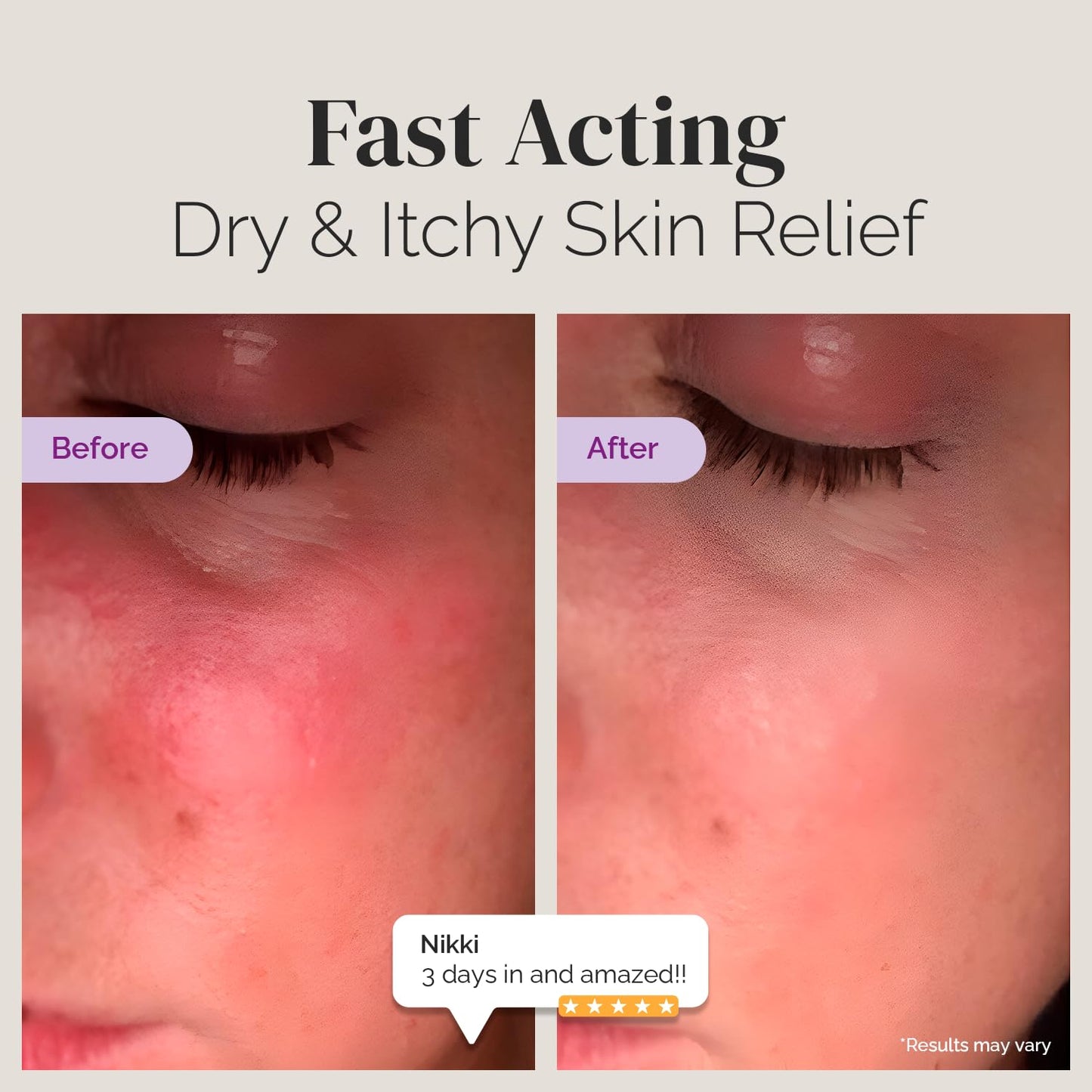 Puriya National Eczema Association Accepted Cream 4.5 oz, Dry Itchy Skin Relief, Colloidal Oatmeal Lotion, For Kids, Adults, Face, Hands, Mother of All Creams, Plant-Based Hydration,No Fragrance Added