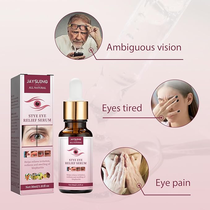 Stye Eye Treatment, Chalazion Remover, Gently Cleanses Lashes and Eyes, Restore Healthier Eye Skin