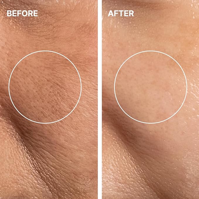 THOME G-Peel Program (12 Sheets) | 4-Step Gentle Peeling for All Skin Types, Sensitive & Dry Skin | Perfect Routine to address fine wrinkles, lines, and hyperpigmentation