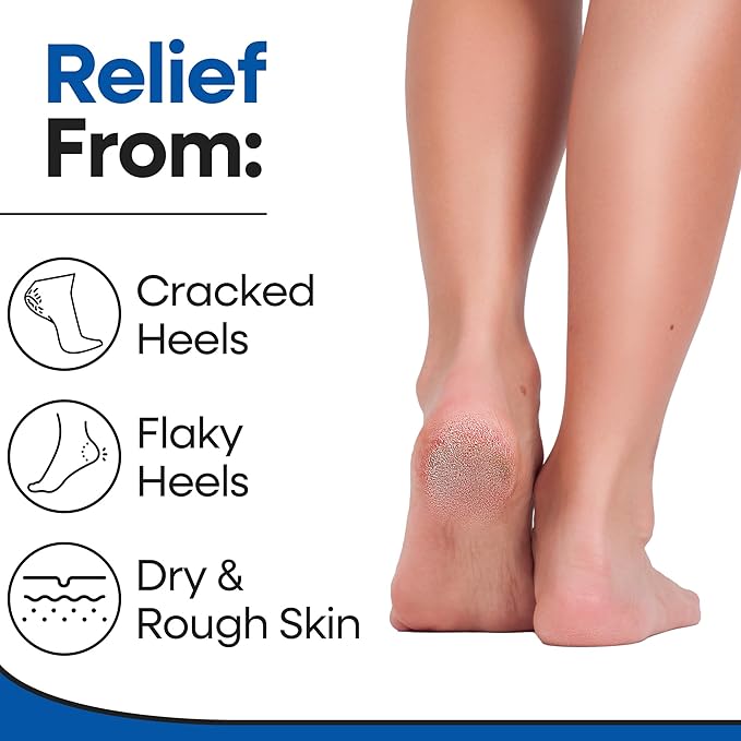 Moisturizing Socks for Men & Women | Aloe Vera Cracked Heel Treatment | Foot Callus Remover | Aloe Socks for Cracked Heels & Dry Feet | Lotion Infused Gel Heel Sleeves (Large - 2 Pairs)