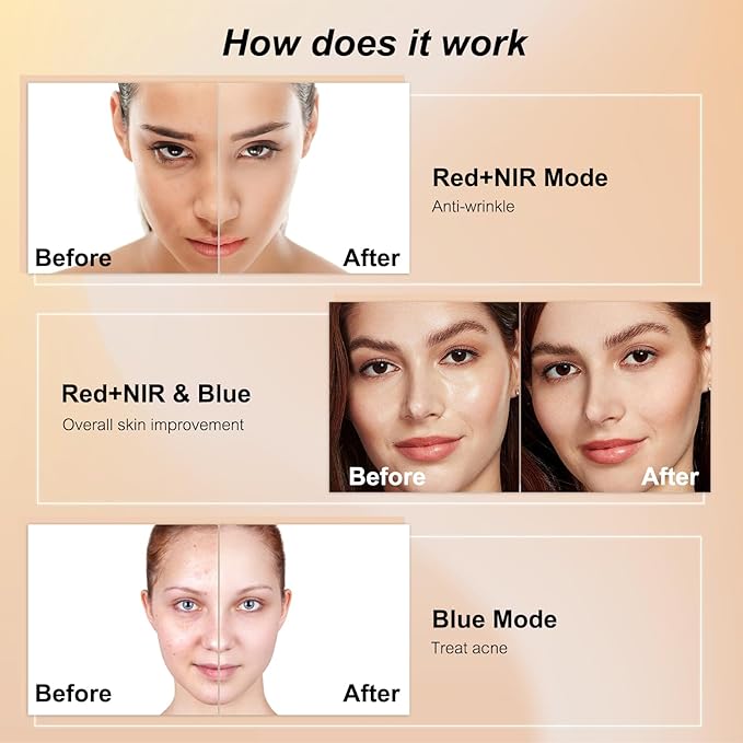 Beauty LED Light Mask -infrared light therapy red light therapy led facial light Photons Facial Skin Care Wrinkle reduce anti-acne facial light acne treatment beauty device-KFB265