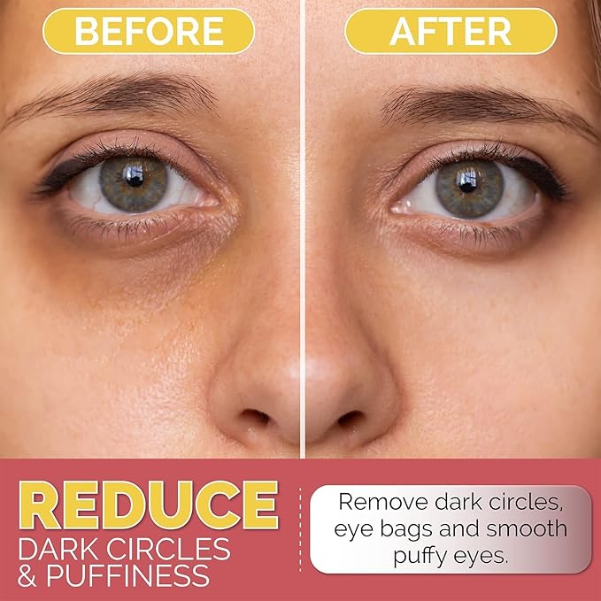 Under Eye Patches for Dark Circles, Puffiness and Eye Bags with 24K Gold - Anti-Wrinkle for Puffy Eyes, Eye Masks with Hyaluronic Acid and Collagen Hydrogel Eye Gel Pads, Premium Korean Skincare 30pcs