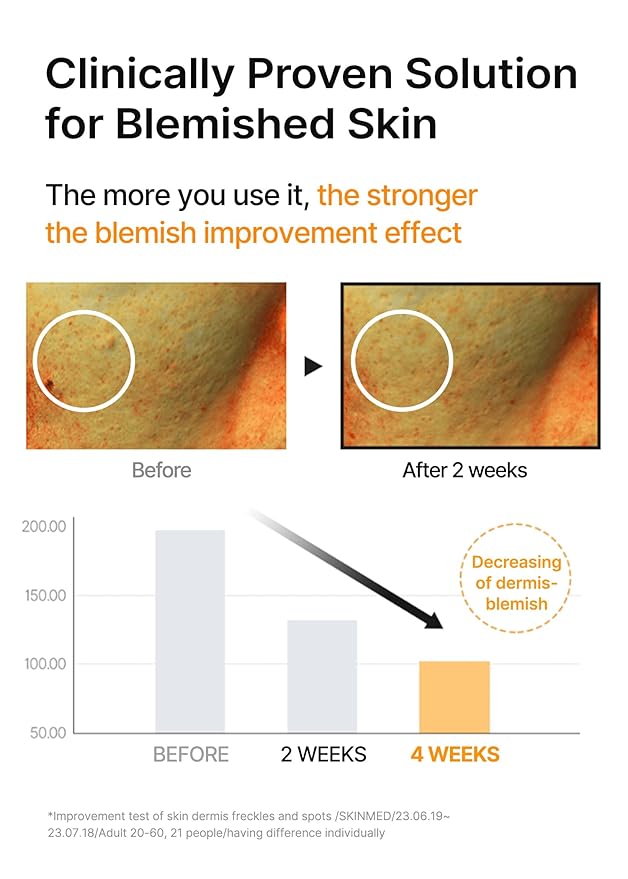 celimax Pore+Dark Spot Brightening Serum 30ml | Gel-like Serum for Enlarged Pores with Niacinamide, Tranexamic Acid, Pore Minimizer, Non-Irritating, Hydrating, For Sensitive Skin, hyperpigmentation