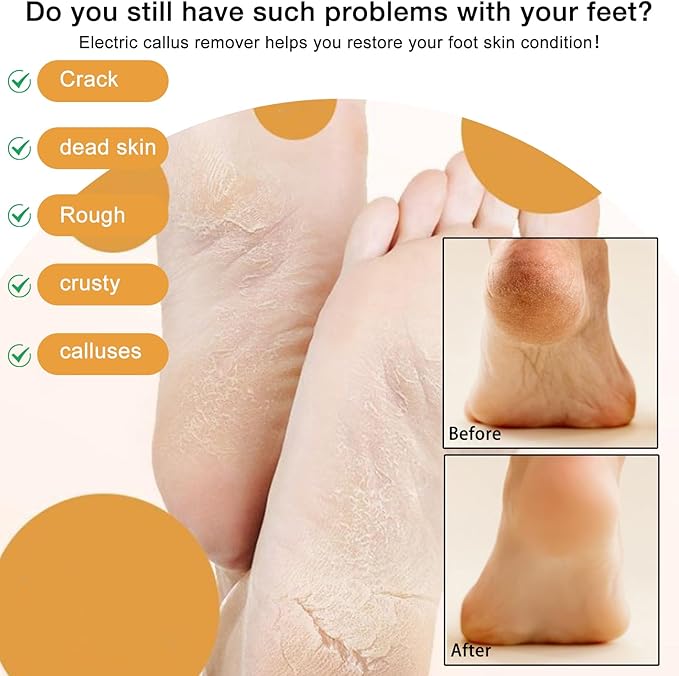 Electric Foot Callus Remover, 2024 New USB Rechargeable Foot Repair and Grinding Device, Heel Polisher Digital Display, Electric Foot Exfoliating Scrubber with 3 Grinding Heads 2 Speeds (Blue)