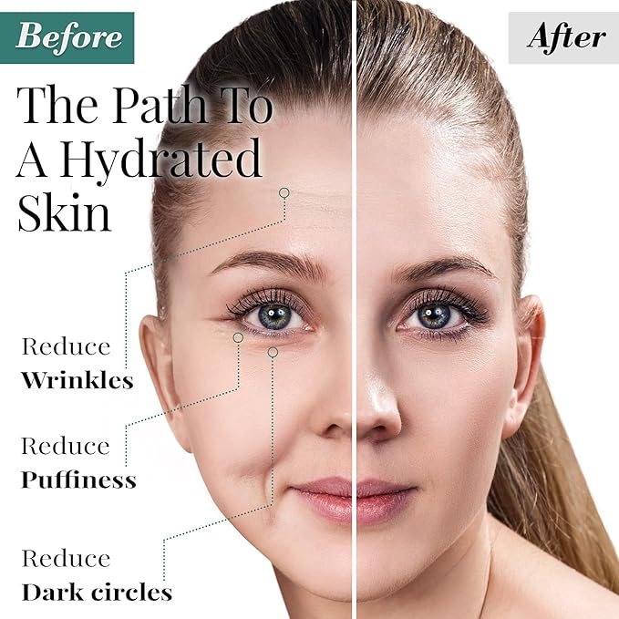 Forehead and Under Eye Wrinkle Patches for Face - Collagen, Hyaluronic Acid and Vitamin A Skin Pads - Forehead Line Remover Wrinkle Eye Patch Set - 26 Strawberry Sachets