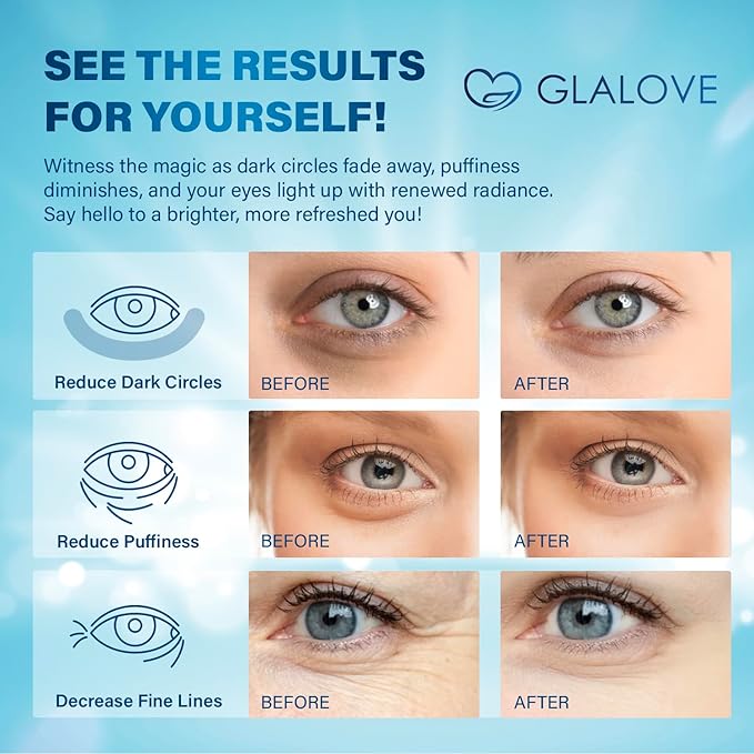 Under Eye Patches for Puffy Eyes: 55 Count Retinol Collagen Eye Gels Pads - Anti-Aging & Rejuvenating Eye Masks Women, Men