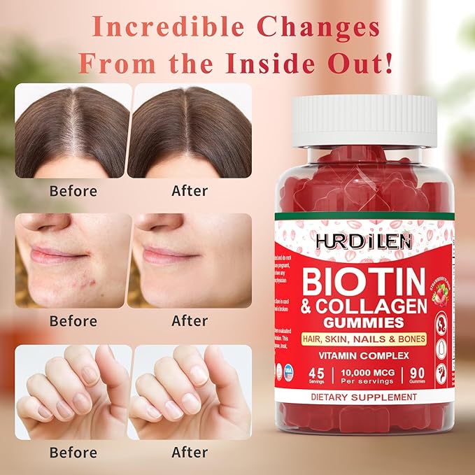 Hair Skin and Nails Gummies, 10000mcg Biotin Collagen Gummies for Women & Men, Vitamin Supplements Supports Faster Hair Growth, Stronger Nails, Healthy Skin, Strength Bone, 90 Gummies