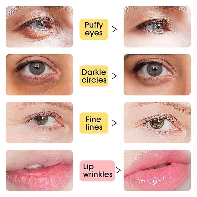 Adofect 40 Pairs Under Eye Patches and Lip Mask 24K Gold Eye Mask for Puffy Eyes Collagen Lip Masks and Crystal Eye Mask Reducing Fine Lines for Women and Men (Gold)