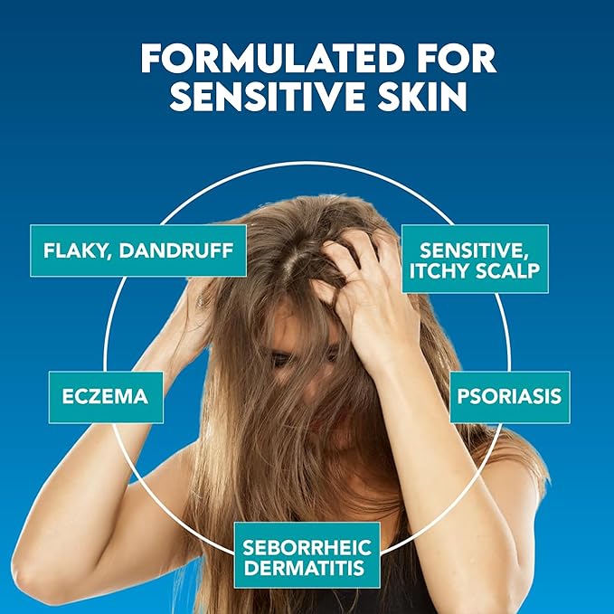 Scalp Care, Rapid Soothing Scalp Relief Spray Moisturiser Treatment, Itchy Scalp Treatments, Spray for Itchy Dry Scalp, Leave In Treatment for Itchy, Sensitive skin, Derm-Formulated,1.35 fl oz