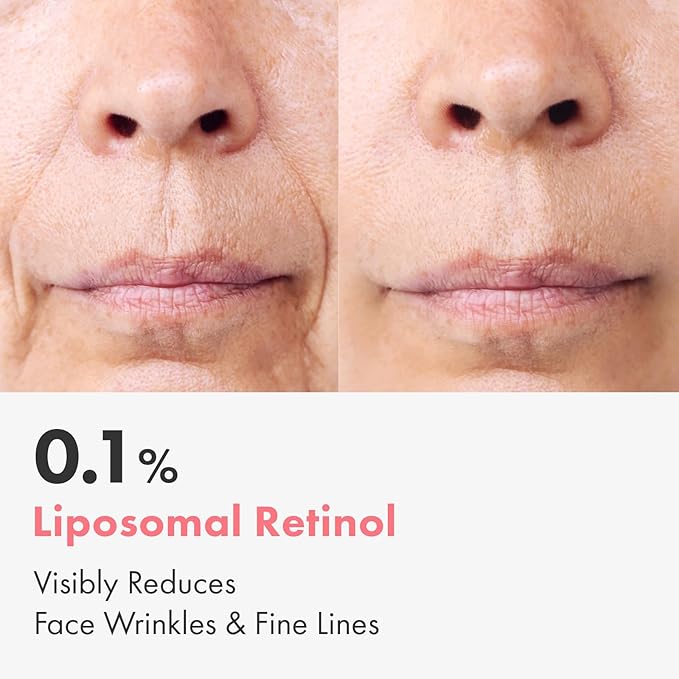 Repair Retinol Cream, Liposomal Retinol 0.1%, Bakuchiol, Retinal, niacinamide, Anti Aging for Face, Eye, Fine Lines & Wrinkles Treatment, Pure Vitamin A, Korean Skincare, 50g, 1.76 oz.