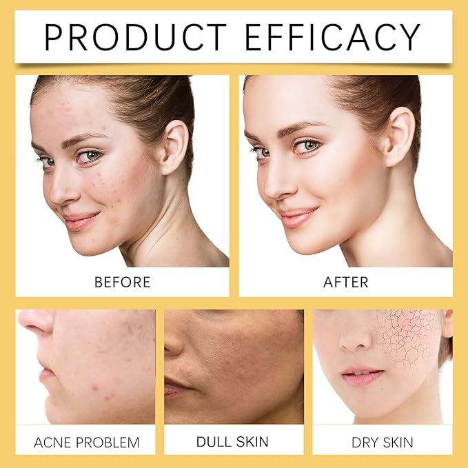 Turmeric Oil for Face, Anti-aging, Remove Excess Grease, Reduce Acne, Improve Dull Skin, Evens Tone, Deep Moisturizing, Cold Press Organic Turmeric Oil for Body, Hair, Skin Moisturizer