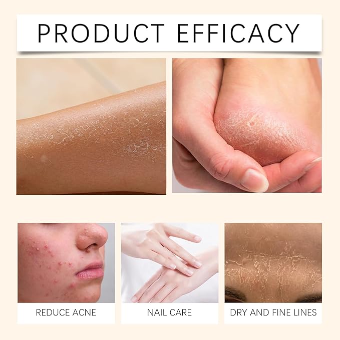 Whipped Shea Butter, 3.53 Oz Multifunctional Shea Butter Lotion for Extremely Dry Skin Body Butter for Women African Shea Butter Body Butter & Hair Butter