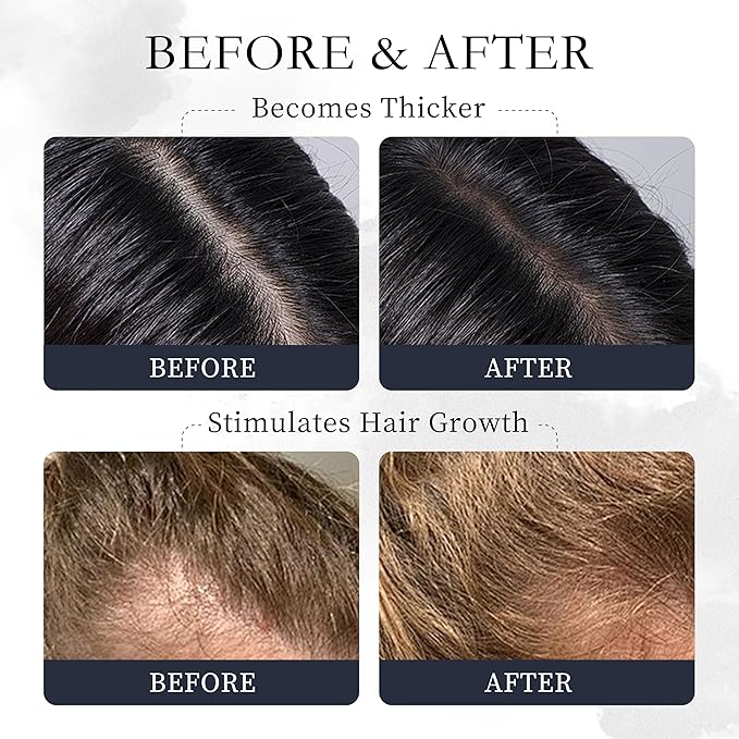 Pure Natural Organic Rosemary Essential Oil, Treats Hair Care Scalp Growth Loss Keratin Collagen Argan Tea Tree Oil Lightweight