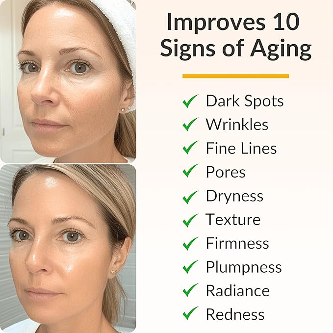 Levaye Vitamin C Serum – Anti Aging Facial Serum with Vitamin C, ferulic acid, Hyaluronic Acid, Vitamin E – Brightening Serum. Targets Dark Spots, Fine Lines, Wrinkles, Dry Skin, Firmness, 1.7 Fl Oz