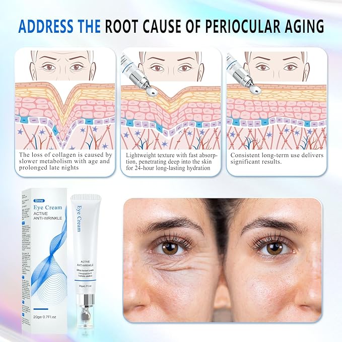 Eye Repair Cream - And Bags Under Eyes,Anti-Aging,Anti-Oxidant,Lightens Fine Lines,Reduces Wrinkles,For Women Under Eye Cream 11