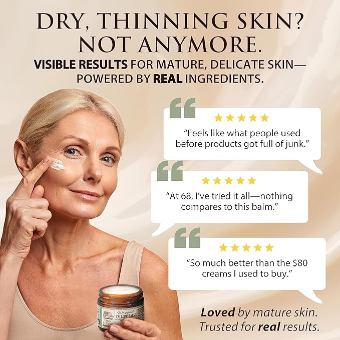 Urban Naturals Handmade Whipped Tallow Balm (Unscented/Herb-Infused) - 100% Grass-fed Organic Body Butter with Infused Jojoba Oil, for Eczema, Rosacea, Baby - 2 oz