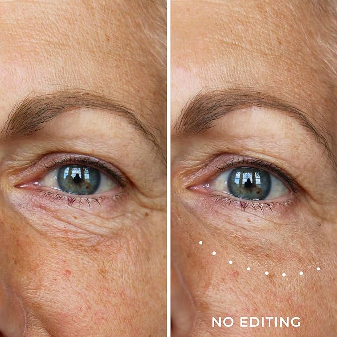 WUNDER2 Wunderlift Instant Eye Tightening Serum, Temporary Firming & Lifting Treatment in 60 Seconds, Reduces Under-Eye Bags, Dark Circles, Puffiness, Anti-aging Fine Lines