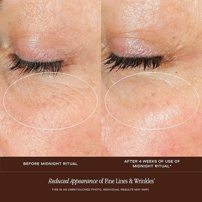 Summer Fridays Midnight Ritual Retinol Serum - Renewal Anti Aging Serum for Face, Fine Lines & Discoloration - Enriched with Jojoba Oil, Hyaluronic Acid & Niacinamide to Renew Skin's Appearance (1 oz)