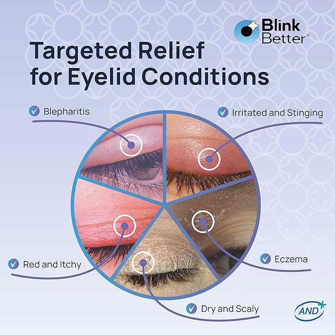 BetterLids Eyelid Ointment – Intense Oat Complex with Shea Butter & Panthenol - Hydrates, Nourishes & Soothes – Moisturizing Care for Dry, Itchy, Red, Sensitive, Flaky Skin Around the Eyes - 0.35 oz