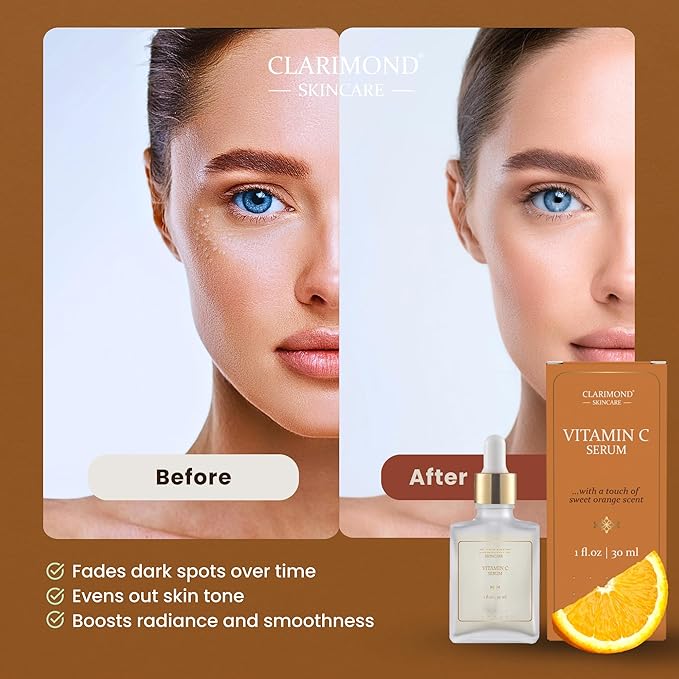 CLARIMOND Vitamin C Multi-Peptides Serum for Face – 20% Vitamin C enriched with Niacinamide & Hyaluronic Acid for Hydration & Glow, Dark Spot Remover & Brightening Serum with Chamomile & Witch Hazel