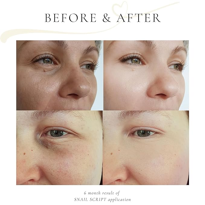 Snail script snail mucin mask, Korean snail face mask mucin snail serum therapy clay based wildcraft botanical anti aging snail mucin face mask, collagen repair, pore cleansing exfoliate clay mask